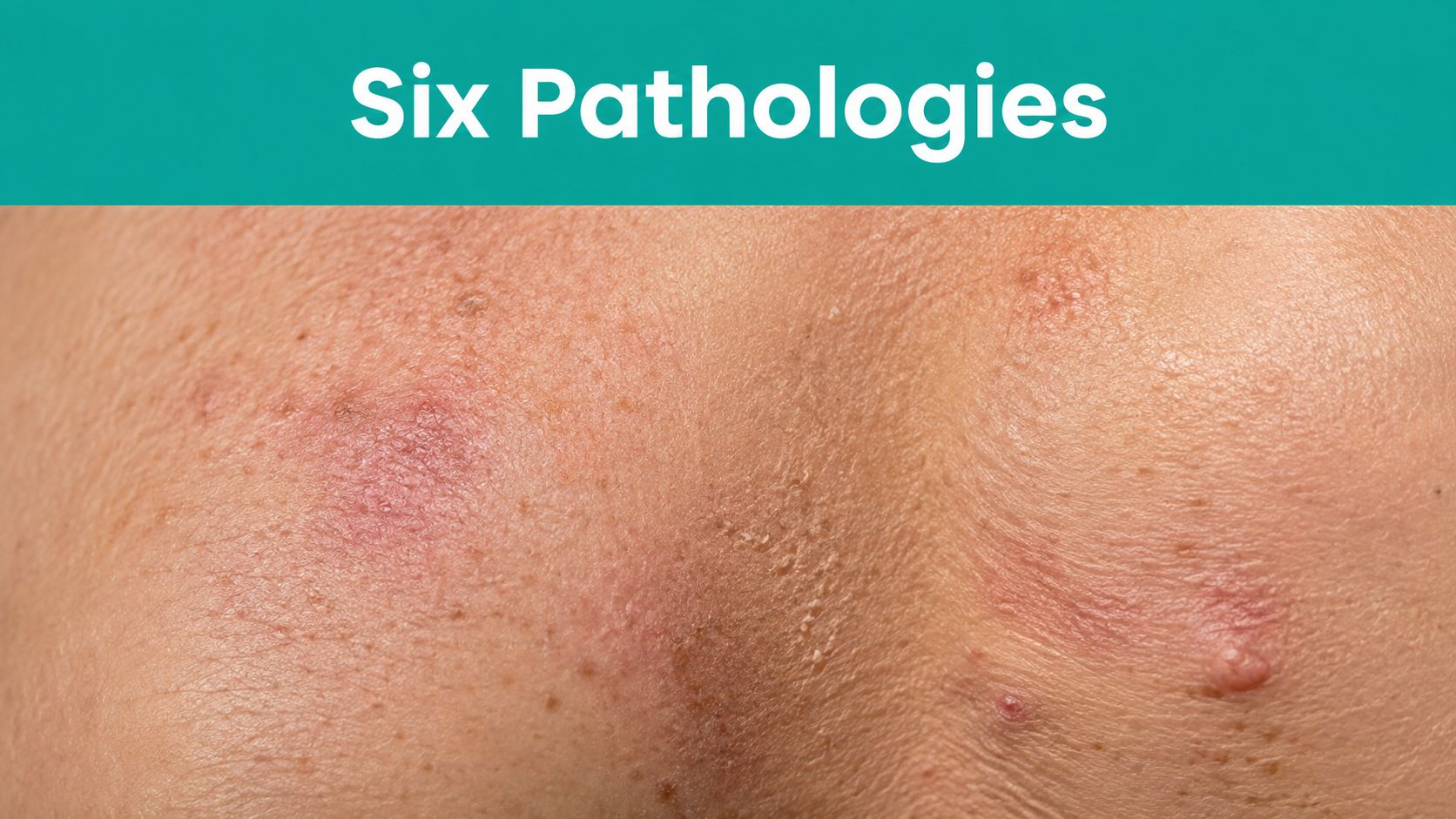 Close-up of human skin showing inflamed, reddish patches and small bumps indicating potential dermatological issues.
